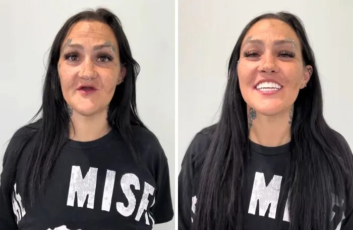 53 Dental Transformations That Led To Striking Glow-Ups