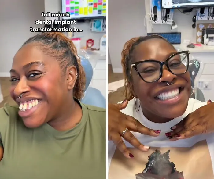 53 Dental Transformations That Led To Striking Glow-Ups