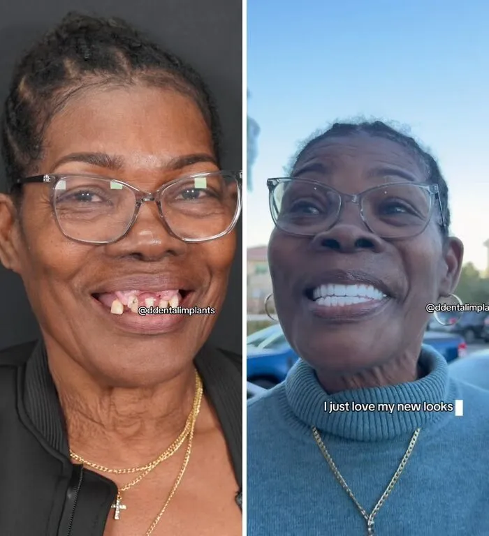53 Dental Transformations That Led To Striking Glow-Ups