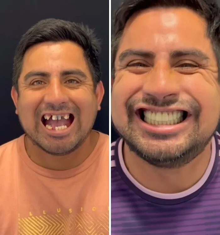 53 Dental Transformations That Led To Striking Glow-Ups