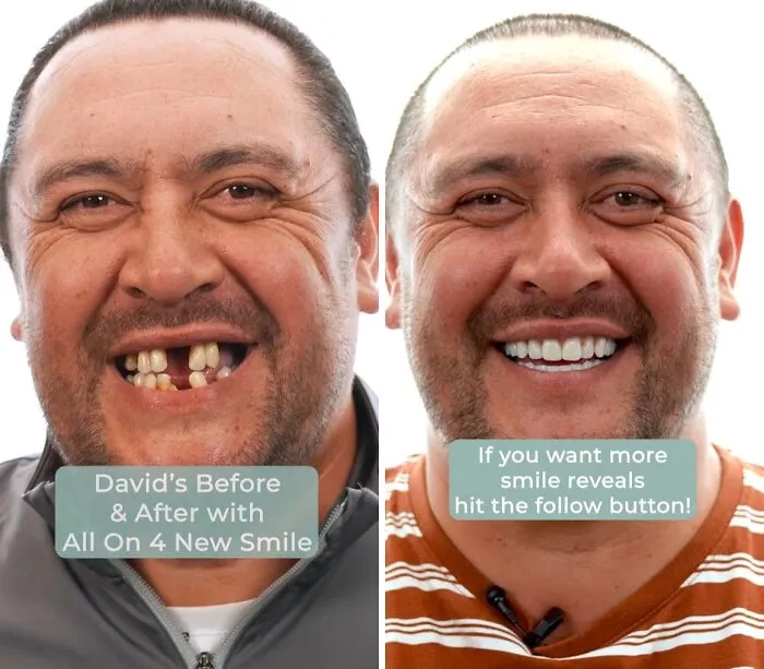 53 Dental Transformations That Led To Striking Glow-Ups