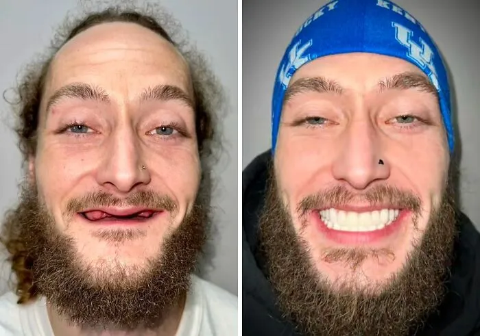 53 Dental Transformations That Led To Striking Glow-Ups