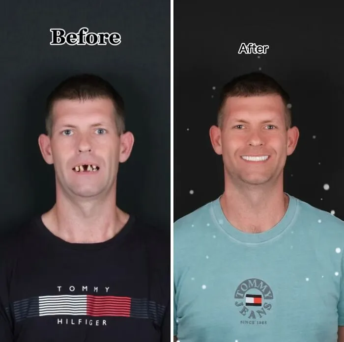 53 Dental Transformations That Led To Striking Glow-Ups