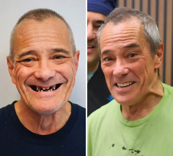 53 Dental Transformations That Led To Striking Glow-Ups