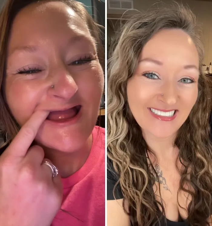 53 Dental Transformations That Led To Striking Glow-Ups