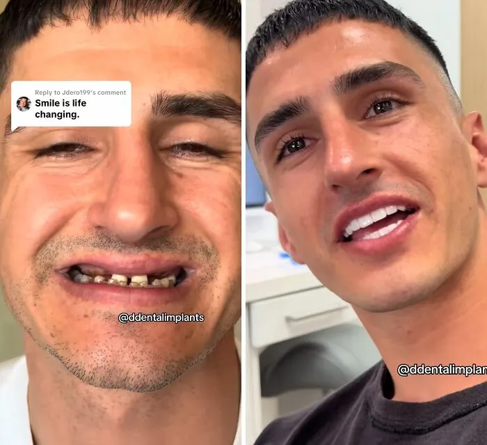 53 Dental Transformations That Led To Striking Glow-Ups