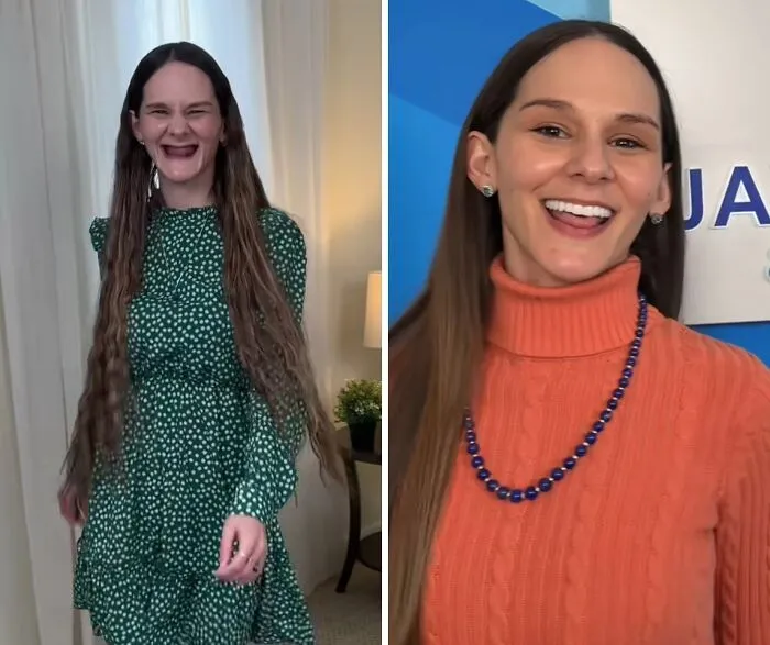 53 Dental Transformations That Led To Striking Glow-Ups