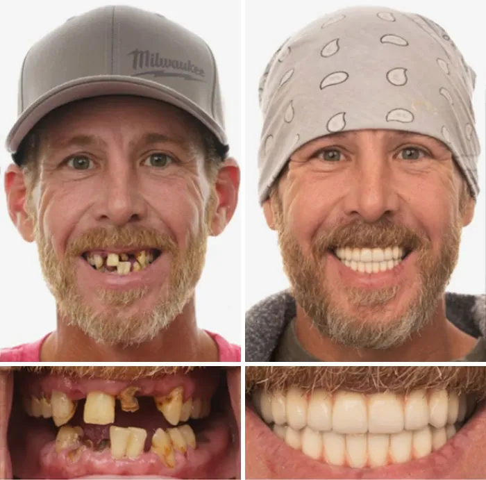 53 Dental Transformations That Led To Striking Glow-Ups