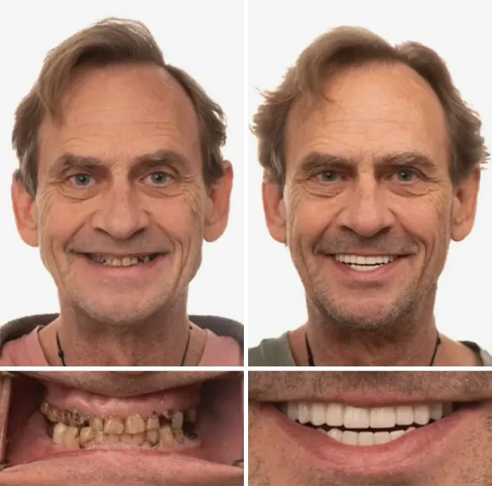 53 Dental Transformations That Led To Striking Glow-Ups