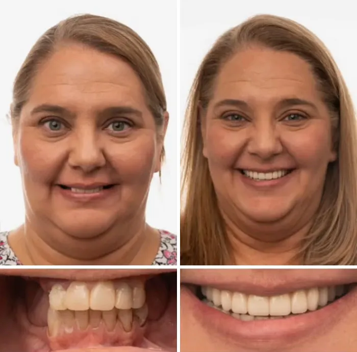 53 Dental Transformations That Led To Striking Glow-Ups