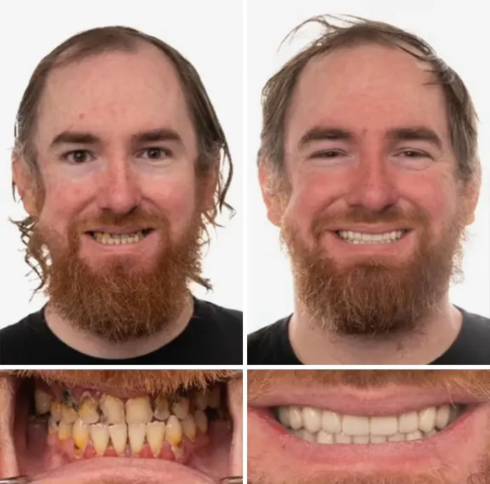53 Dental Transformations That Led To Striking Glow-Ups