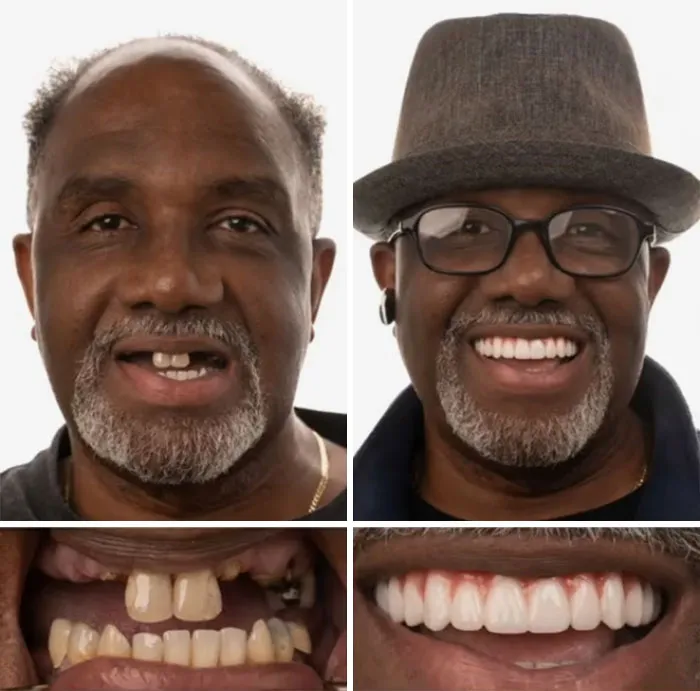 53 Dental Transformations That Led To Striking Glow-Ups