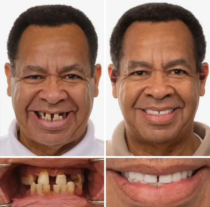 53 Dental Transformations That Led To Striking Glow-Ups