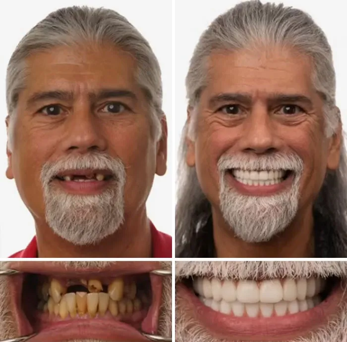 53 Dental Transformations That Led To Striking Glow-Ups