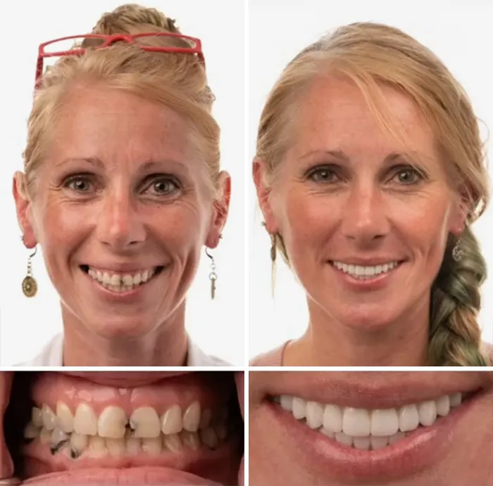 53 Dental Transformations That Led To Striking Glow-Ups