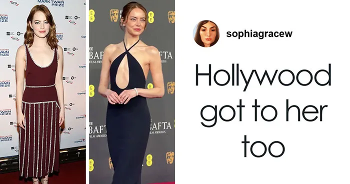 "Sends The Wrong Message To Young Women": Emma Stone's Look At 2026 BAFTAs Worries Many