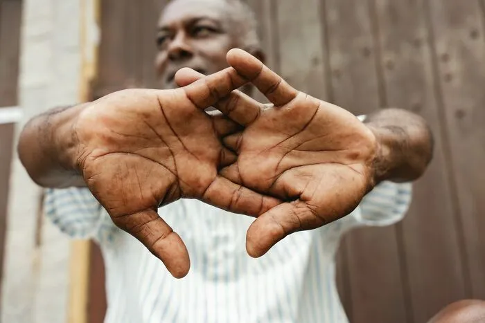 Man showing close-up of hands with visible lines and textures, illustrating well-known facts that are actually fake.
