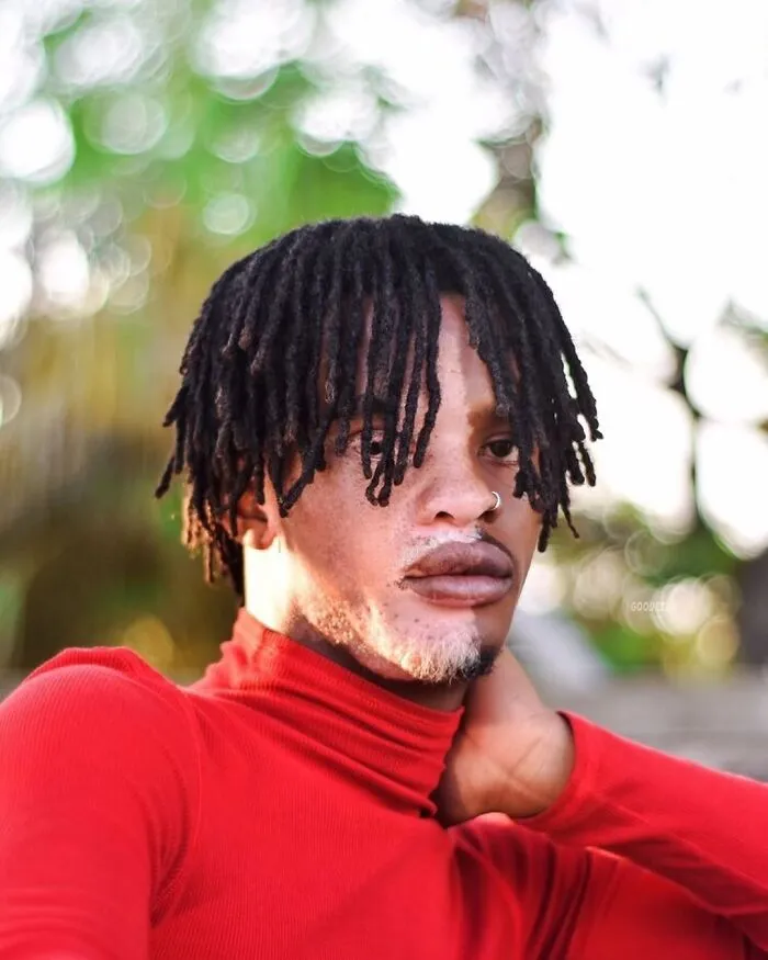 35 Breathtaking Photos Of People With Vitiligo That Redefine What Beauty Looks Like