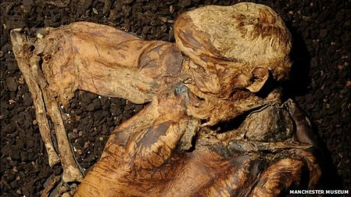 "The First Leper": 25 Times Archaeologists Dug Up Something Straight Out Of A Nightmare
