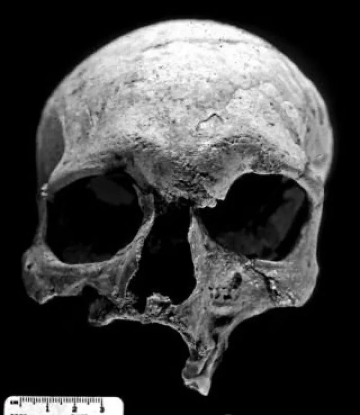 "The First Leper": 25 Times Archaeologists Dug Up Something Straight Out Of A Nightmare