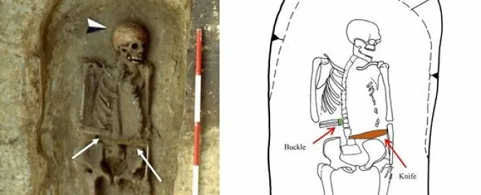"The First Leper": 25 Times Archaeologists Dug Up Something Straight Out Of A Nightmare