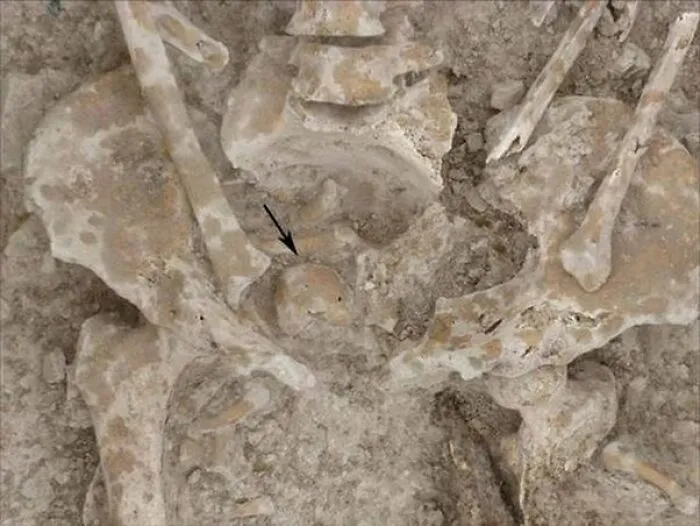 "The First Leper": 25 Times Archaeologists Dug Up Something Straight Out Of A Nightmare