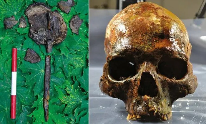 "The First Leper": 25 Times Archaeologists Dug Up Something Straight Out Of A Nightmare