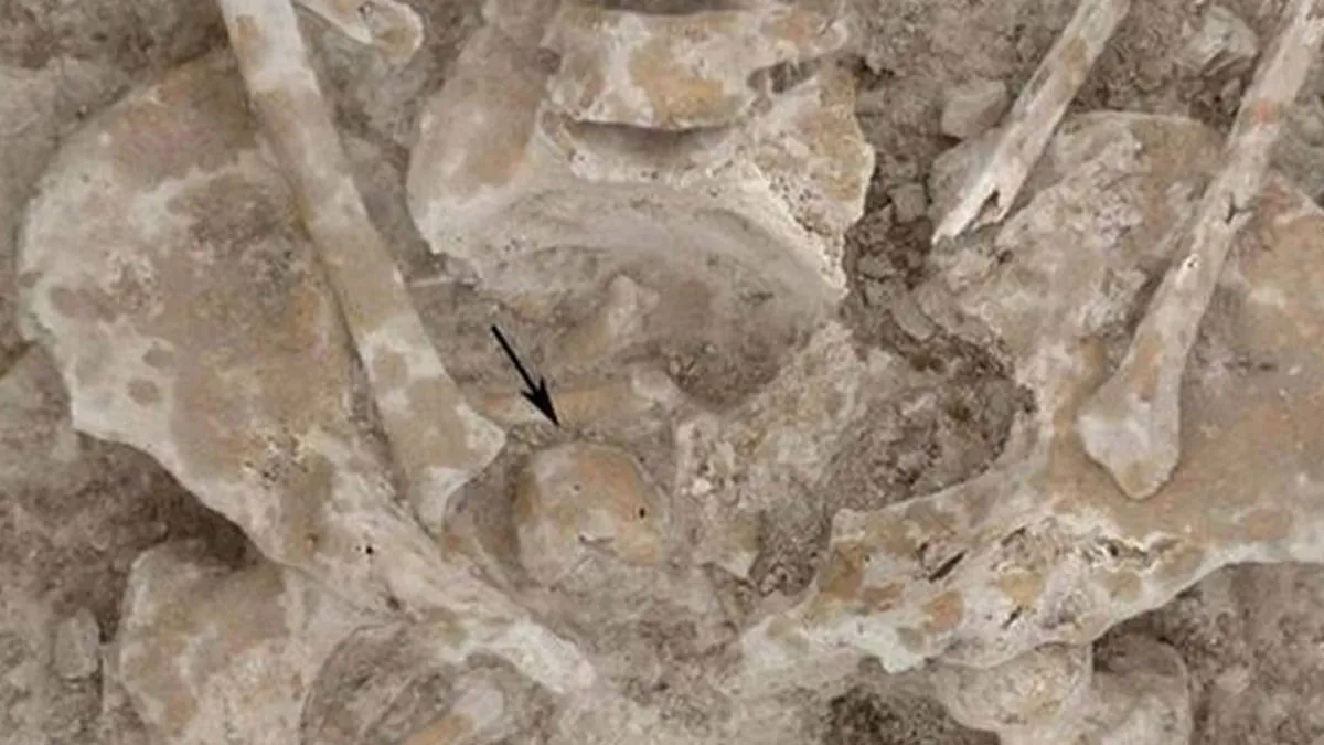 "The First Leper": 25 Times Archaeologists Dug Up Something Straight Out Of A Nightmare