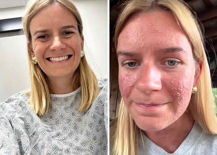 The Nighttime Bite That Became A Medical Mystery