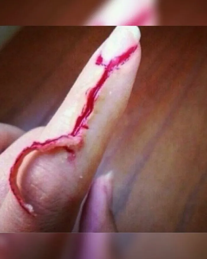 Severe finger injury with unusual deep laceration and exposed flesh, depicting unusual medical photos between science and nightmare.