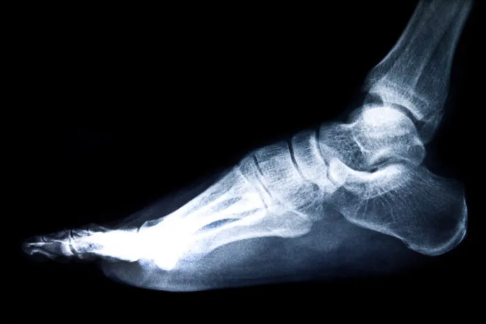 36 Insane Cases Of Patients Definitely Faking An Illness, That Doctors Experienced In Their Careers