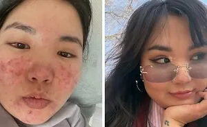 31 People Who Are Completely Unrecognizable From Who They Were 3 Years Ago
