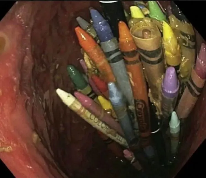 30 Imágenes médicas fascinantes pero ligeramente inquietantes