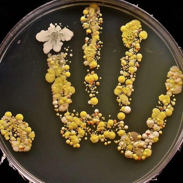 Petri dish showing unusual bacterial growth in the shape of a hand, illustrating unusual medical photos between science and nightmare.