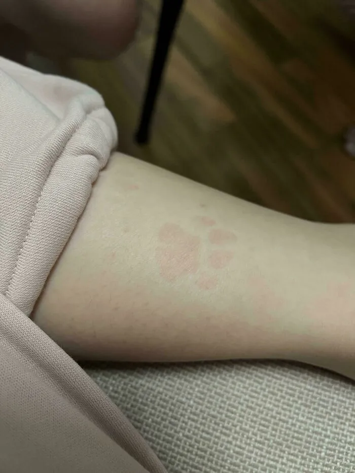 Paw Print From My Cat Sitting On Me For 5 Minutes