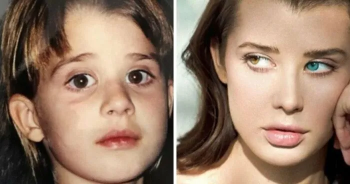 Instagram "Influencer" Called Out By Her Own Dad For Claiming To Have Heterochromia