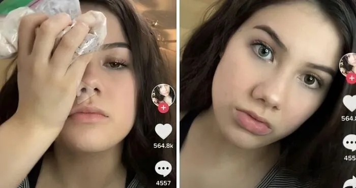 This Influencer Is Telling Children On TikTok It's Okay To Put Bleach In Their Eyes, Claiming It Changes Eye Color