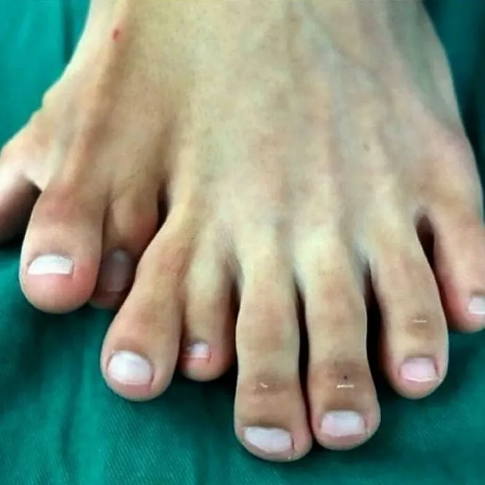 30 Imágenes médicas fascinantes pero ligeramente inquietantes