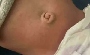 People Share 65 Photos Of The Unusual Things That Happened To Their Bodies