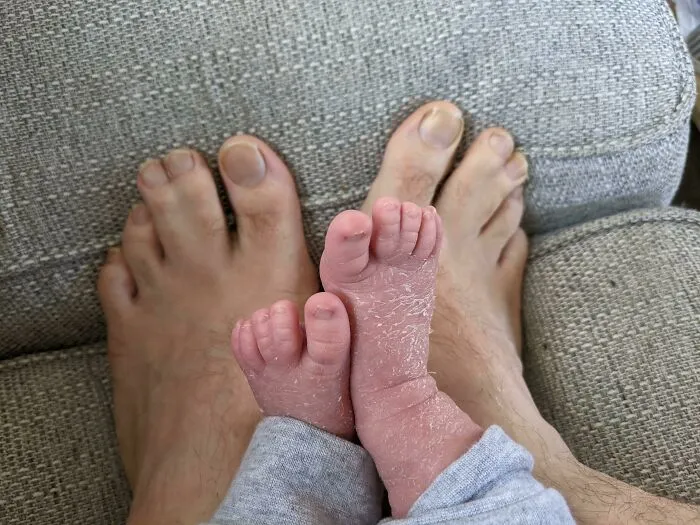 My Son Inherited My Joined Together Toes