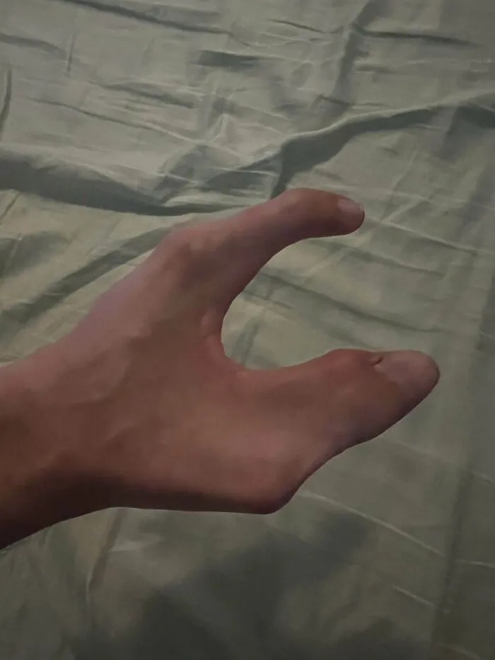 Weird Hand Post. Was Born Like This
