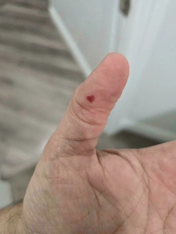 Ampolla de sangre que parece un corazón
