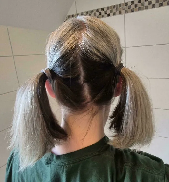 Mi cabello solo es gris/blanco en la parte superior.