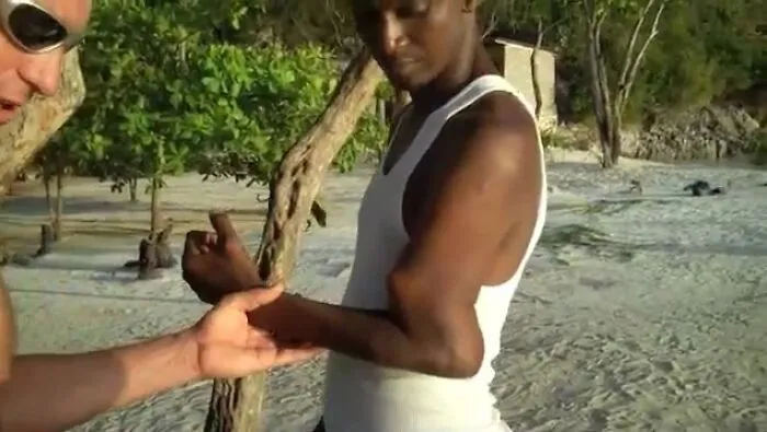 Un niño haitiano, cuyo brazo roto quedó sin tratamiento.