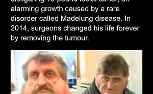“Something Out Of A Nightmare”: 83 Disturbing Real-Life Facts That Might Haunt Your Mind (New Pics)