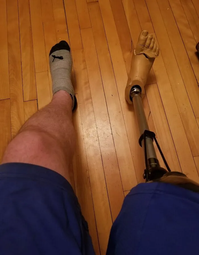 My Friend's Dog Thought The Foot On My Prosthesis Was A Chew Toy