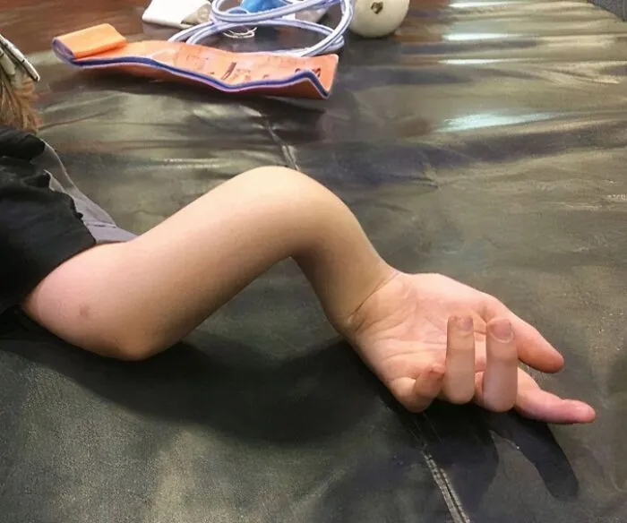 Child's arm bent at an unusual angle resting on a black surface, illustrating unusual medical photos between science and nightmare.
