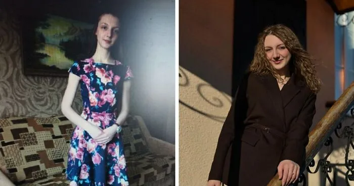 31 People Who Are Completely Unrecognizable From Who They Were 3 Years Ago