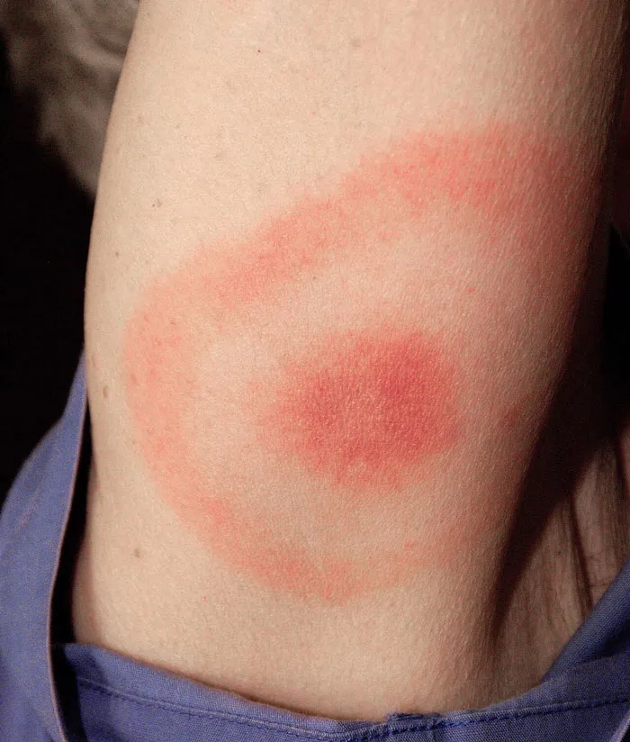 37 Doctors Share Which Diseases Should Scare People More Than They Do