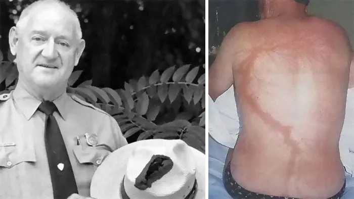 “Should Have Been 100% Fatal”: 49 Times Humans Survived The Most Terrifying Situations